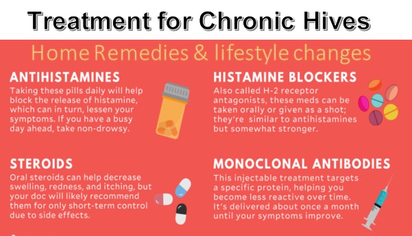 Treatment-for-Chronic-Hives what is chronic hives ? Causes, Triggers & Treatments
