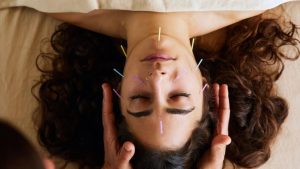 Yin Tang Acupuncture