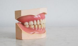 tips for teeth whitening