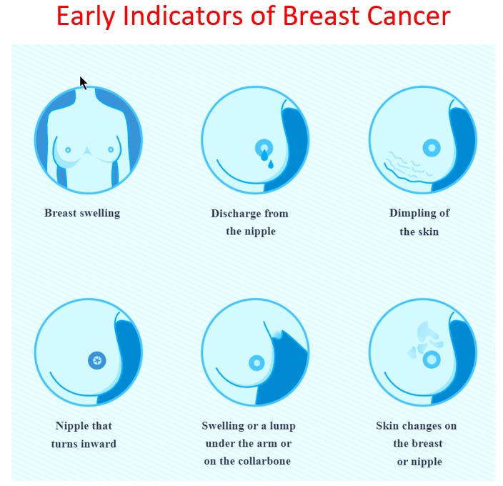 Early-Indicators-of-Breast-Cancer What are the Early Indicators of Breast Cancer?
