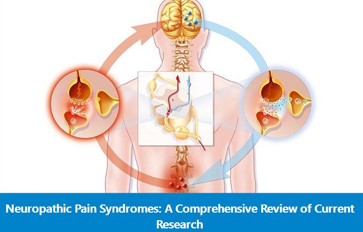 Neuropathic Pain Syndromes Review of Current Research