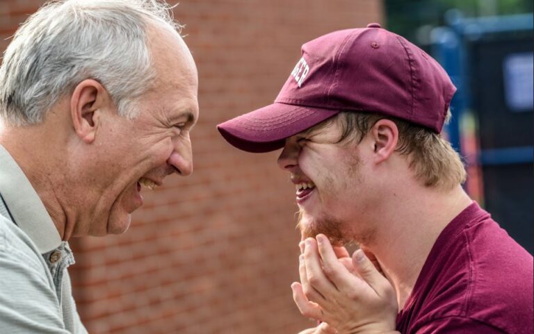 Buccal Fat Pad Removal