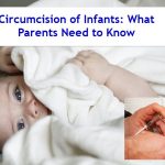 Circumcision of infants