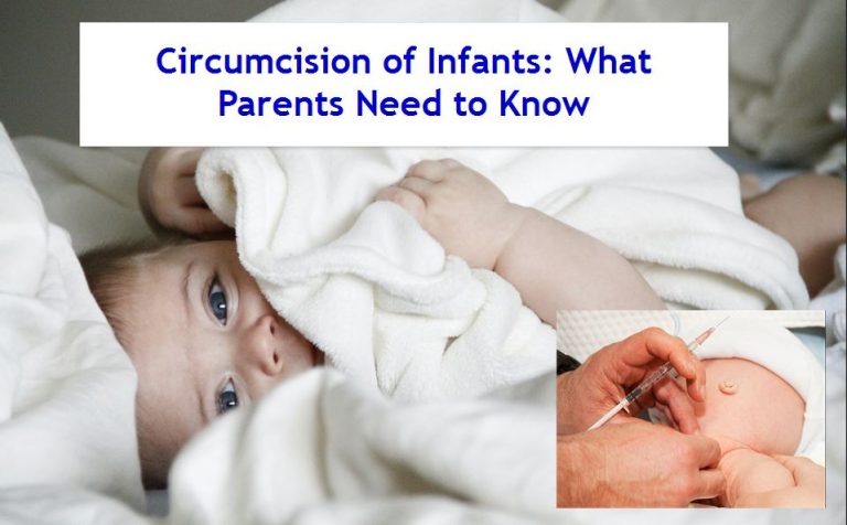 Circumcision of infants