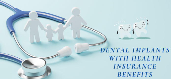 How To Get Dental Implants Covered By Medical Insurance?