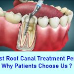 Best Root Canal Treatment Perth
