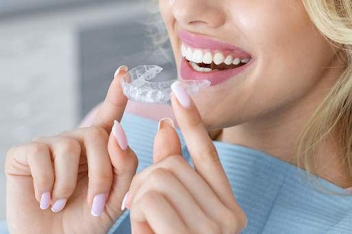 orthodontist aligners